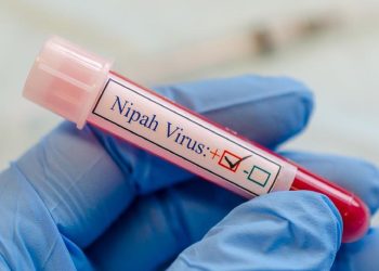 Virus Nipah dan Cara Penyebarannya Menurut Penjelasan Pakar